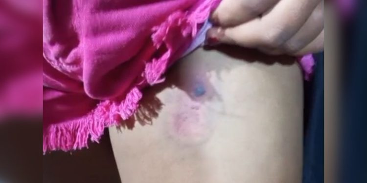 Veja momento em que criança é ferida com bala de borracha pela PMDF