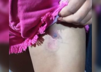 Vídeo: criança é ferida por bala de borracha durante operação da PMDF