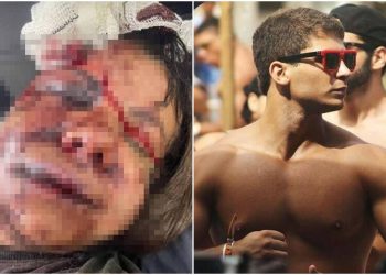 Desfigurada, vítima espancada por ex só conseguiu depor por escrito