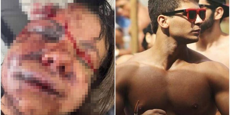 Mulher espancada com 60 socos pelo ex: “Ele disse que iria me matar”