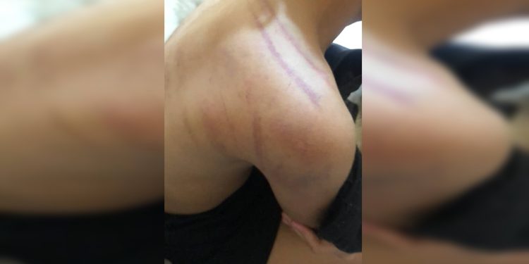 Chinelada e soco no olho: menina é espancada por pai ao tomar Toddynho