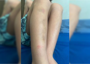Filho de publicitário preso e agredido por agentes ficou com hematomas