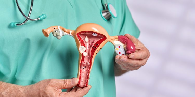 SUS passa a oferecer dois novos tratamentos para endometriose