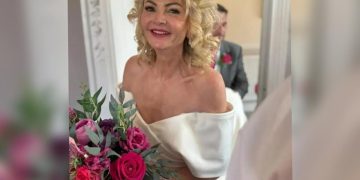 Mulher tem paralisia no rosto após lua de mel ser cancelada na véspera