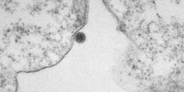 Pesquisa mostra ação do vírus oropouche em imagens de microscopia