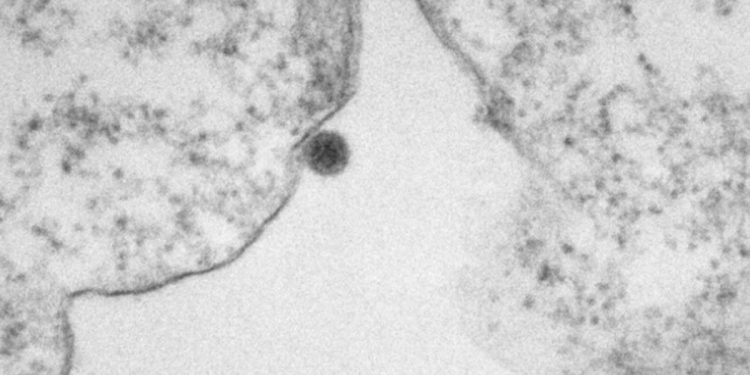 Pesquisa mostra ação do vírus oropouche em imagens de microscopia