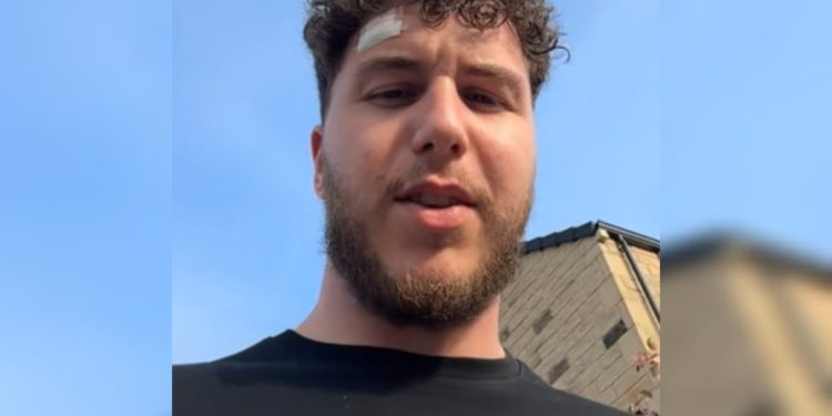 Jovem ignora sintoma clássico na testa e é diagnosticado com câncer