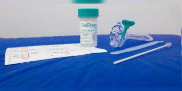 SUS inicia troca de papanicolau por exame de DNA. Entenda o novo teste