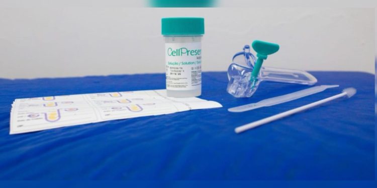 SUS inicia troca de papanicolau por exame de DNA. Entenda o novo teste