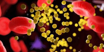 Magro pode ter colesterol alto mesmo com peso ideal, entenda por quê