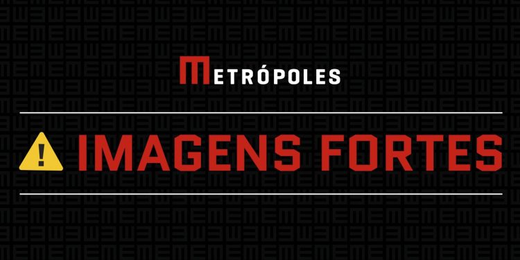 Há um mês esperando por cirurgia, paciente corre risco de perder o pé