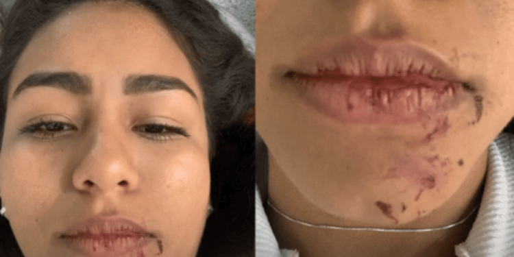 “Cena de terror”, diz sobrevivente de acidente com BMW que matou jovem