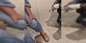 Jovem picada por escorpião em loja de shopping tem alta médica