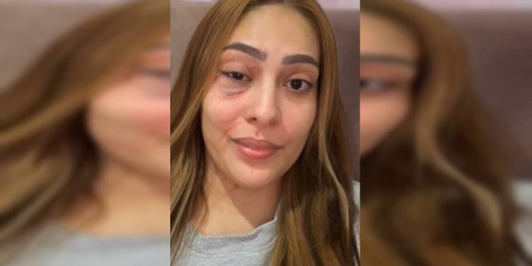 “Você provocou”, diz esposa de homem de cueca que atacou mulher no DF