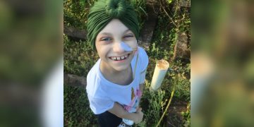 Menina morre de câncer após ter sintomas confundidos com escoliose