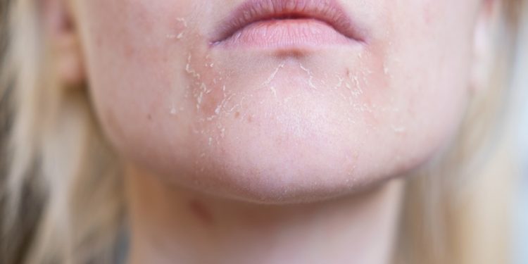 Pele pode revelar os primeiros sinais de diabetes e colesterol alto