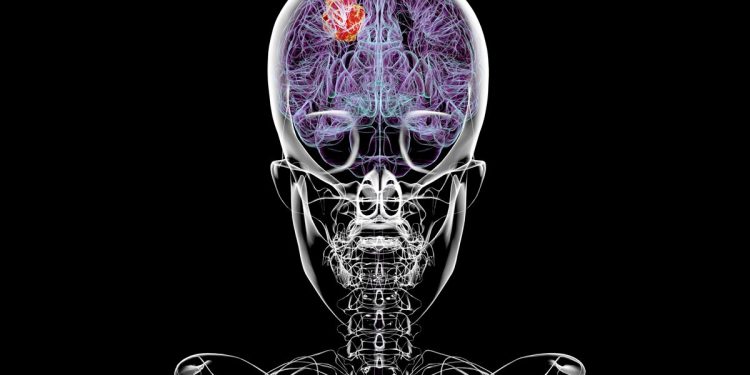 Dieta pode melhorar efeito de tratamento contra tumor cerebral grave