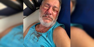 Vídeo: motorista se irrita após batida e espanca homem de 68 anos no DF