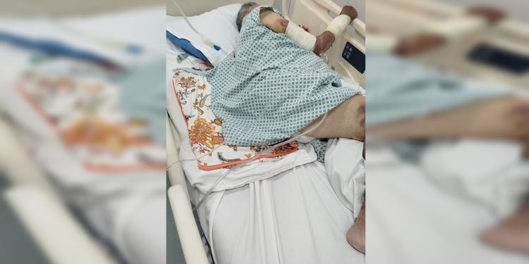 “Pele rasgada”: família de paciente reclama de maus-tratos em UPA