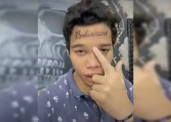 Saiba quem é o jovem que tatuou Bolsonaro na testa e depois removeu