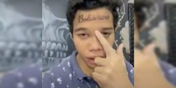 Saiba quem é o jovem que tatuou Bolsonaro na testa e depois removeu