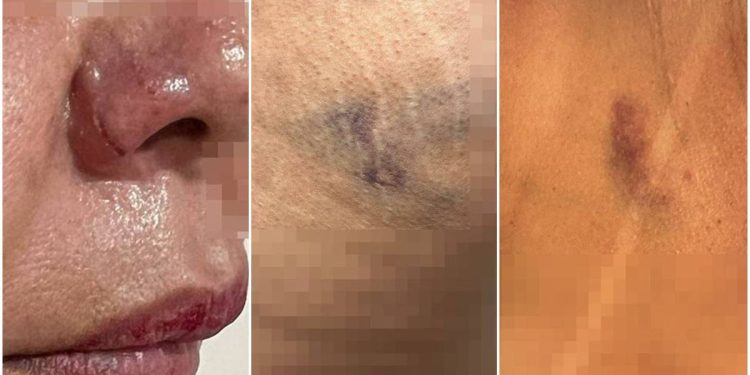 “Se não ficar comigo, eu te mato”: homem é preso após agredir mulher