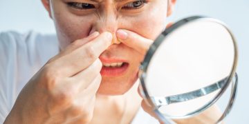 Só uma cutucada! Por que sentimos tanta vontade de espremer espinhas?