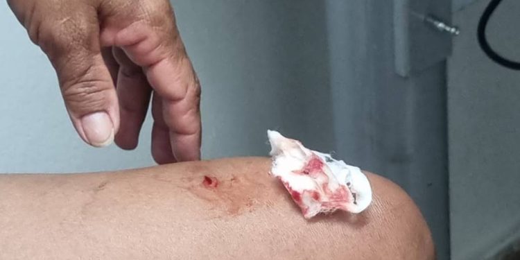 Vídeo: mulher é atacada e mordida por macaco na Água Mineral