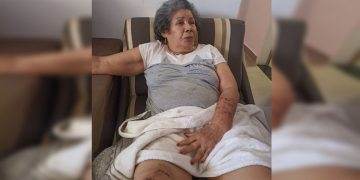 Idosa ferida por cães soltos na rua detalha ataque: “Estavam violentos”