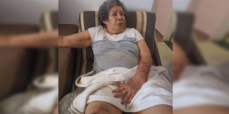 Idosa ferida por cães soltos na rua detalha ataque: “Estavam violentos”