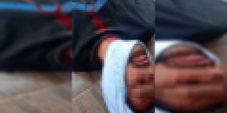 Bebedeira e facada na jugular: homem acusa amigo de furto e o ataca