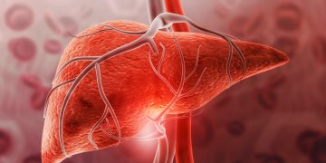 Gordura no fígado: saiba em quanto tempo é possível reverter o quadro