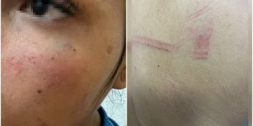 Socos, chutes e ameaça da morte: mulher é violentada pelo namorado