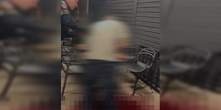 Homem ameaça ex no DF, mesmo gravemente ferido no braço: “Cadê tu?”