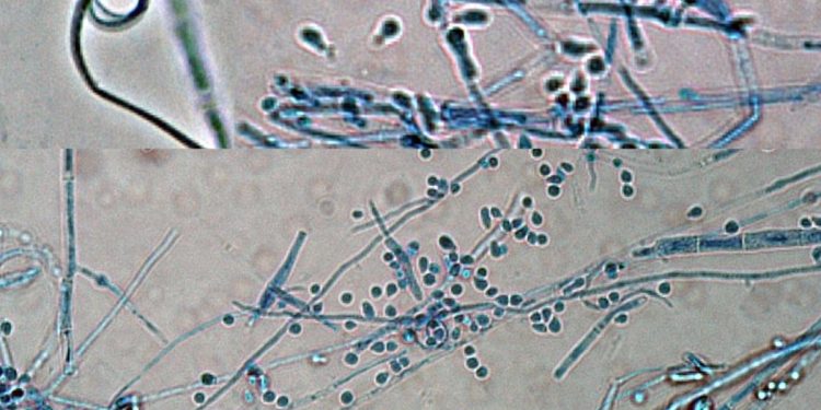 Alta em casos de superfungo que causa lesões na virilha acendem alerta