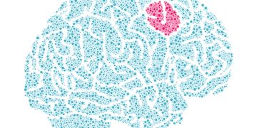 Estudo revela como tumores cerebrais reagem à falta de nutrientes