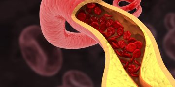 Cardiologistas apontam hábitos que ajudam a “limpar” as artérias