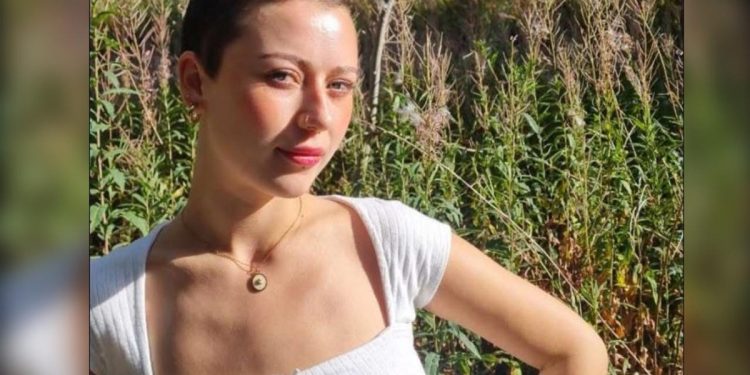 Jovem de 23 anos perde todo o cabelo após crise de estresse no trabalho