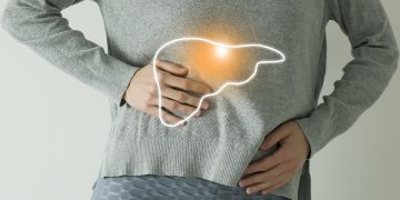 Gordura no fígado: como reconhecer os sintomas e identificar a doença