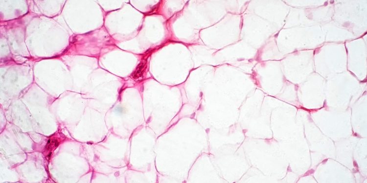 Cientistas conseguem potencializar células para queimar mais calorias