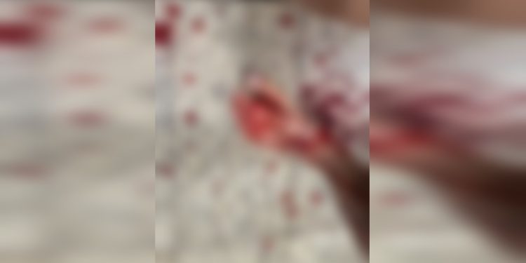 Homem tenta invadir hospital e matar esposa esfaqueada diante da filha