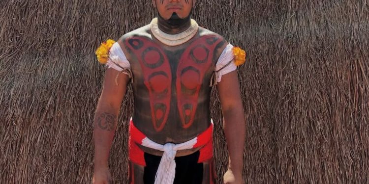 Jovem indígena espera cirurgia de urgência no DF e situação se agrava