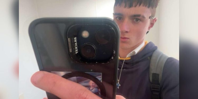 Vício em cigarro eletrônico faz adolescente perder pedaços do pulmão