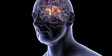 Cardiologista indica principais sintomas de AVC e como reduzir o risco