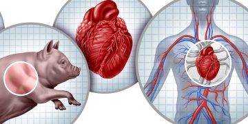 Xenotransplante: médicos dizem como técnica promissora avançou em 2025