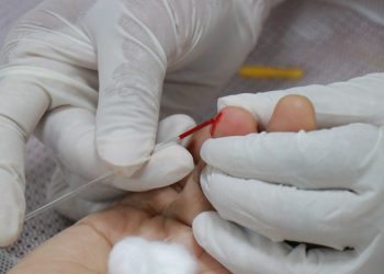 Endocrinologista explica como reconhecer sinais precoces da diabetes