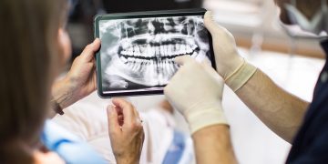 Perda de dentes em idosos piora a saúde e aumenta o risco de morte