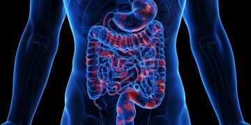 Médico ensina como identificar inflamação ligada à síndrome metabólica