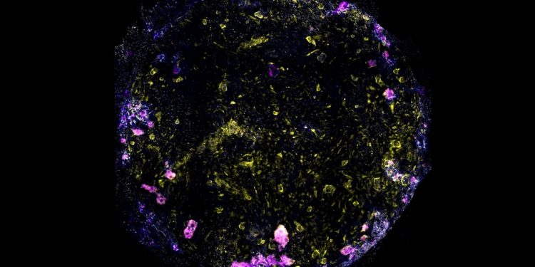 Cientistas criam minipulmão para estudar como a tuberculose o infecta