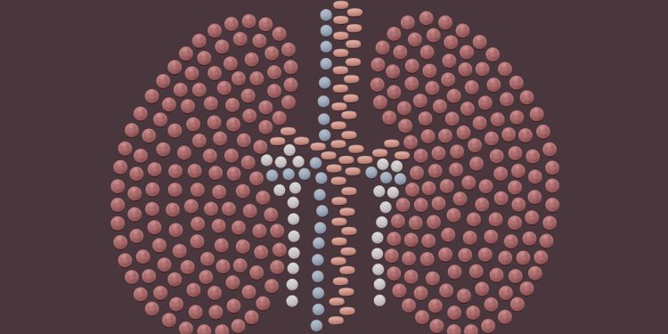 Remédio usado para artrite pode melhorar rins doados para transplante